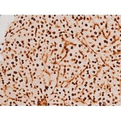 Invitrogen Phospho-SYK (Tyr348) Polyclonal Antibody 100 &mu;L | Buy Online | Invitrogen&trade; | Fisher Scientific