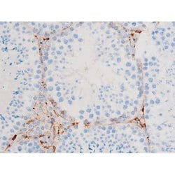 Invitrogen Phospho-SYK (Tyr348) Polyclonal Antibody 100 &mu;L | Buy Online | Invitrogen&trade; | Fisher Scientific