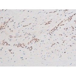 Invitrogen Phospho-SYK (Tyr348) Polyclonal Antibody 100 &mu;L | Buy Online | Invitrogen&trade; | Fisher Scientific
