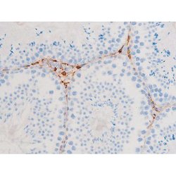 Invitrogen Phospho-SYK (Tyr348) Polyclonal Antibody 100 &mu;L | Buy Online | Invitrogen&trade; | Fisher Scientific