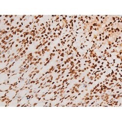 Invitrogen Phospho-SYK (Tyr348) Polyclonal Antibody 100 &mu;L | Buy Online | Invitrogen&trade; | Fisher Scientific