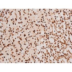 Invitrogen Phospho-SYK (Tyr348) Polyclonal Antibody 100 &mu;L | Buy Online | Invitrogen&trade; | Fisher Scientific
