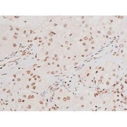 Invitrogen Phospho-SYK (Tyr348) Polyclonal Antibody 100 &mu;L | Buy Online | Invitrogen&trade; | Fisher Scientific
