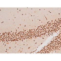 Invitrogen Phospho-SYK (Tyr348) Polyclonal Antibody 100 &mu;L | Buy Online | Invitrogen&trade; | Fisher Scientific