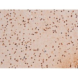 Invitrogen Phospho-SYK (Tyr348) Polyclonal Antibody 100 &mu;L | Buy Online | Invitrogen&trade; | Fisher Scientific