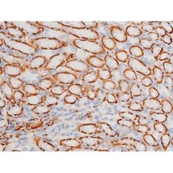 Invitrogen Phospho-SYK (Tyr348) Polyclonal Antibody 100 &mu;L | Buy Online | Invitrogen&trade; | Fisher Scientific