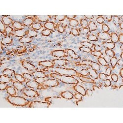 Invitrogen Phospho-SYK (Tyr348) Polyclonal Antibody 100 &mu;L | Buy Online | Invitrogen&trade; | Fisher Scientific