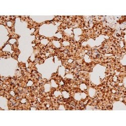 Invitrogen Phospho-SYK (Tyr348) Polyclonal Antibody 100 &mu;L | Buy Online | Invitrogen&trade; | Fisher Scientific