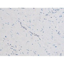 Invitrogen Phospho-SYK (Tyr525) Polyclonal Antibody 100 &mu;L; Unconjugated:Antibodies,