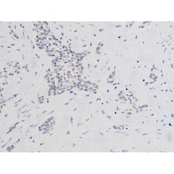 Invitrogen Phospho-SYK (Tyr525) Polyclonal Antibody 100 &mu;L; Unconjugated:Antibodies,