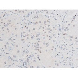 Invitrogen Phospho-SYK (Tyr525) Polyclonal Antibody 100 &mu;L; Unconjugated:Antibodies,