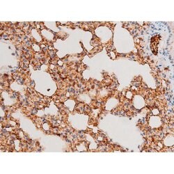 Invitrogen Phospho-SYK (Tyr525) Polyclonal Antibody 100 &mu;L; Unconjugated:Antibodies,