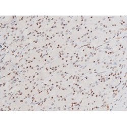 Invitrogen Phospho-SYK (Tyr525) Polyclonal Antibody 100 &mu;L; Unconjugated:Antibodies,