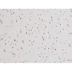 Invitrogen Phospho-SYK (Tyr525) Polyclonal Antibody 100 &mu;L; Unconjugated:Antibodies,