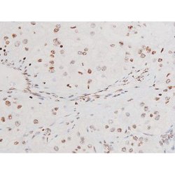 Invitrogen Phospho-SYK (Tyr525) Polyclonal Antibody 100 &mu;L; Unconjugated:Antibodies,