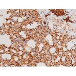 Invitrogen Phospho-SYK (Tyr525) Polyclonal Antibody 100 &mu;L; Unconjugated:Antibodies,