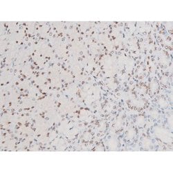 Invitrogen Phospho-SYK (Tyr525) Polyclonal Antibody 100 &mu;L; Unconjugated:Antibodies,