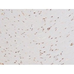 Invitrogen Phospho-SYK (Tyr525) Polyclonal Antibody 100 &mu;L; Unconjugated:Antibodies,