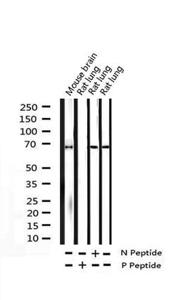 Invitrogen Phospho-SYK (Tyr525) Polyclonal Antibody 100 &mu;L; Unconjugated:Antibodies,