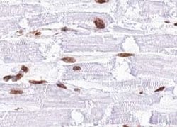 Phospho-MAP2K4 (Thr261) Polyclonal Antibody:Antibodies, Polyclonal