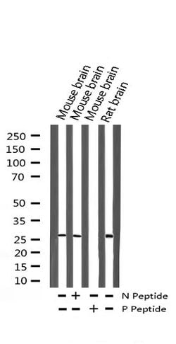 Invitrogen Phospho-p27 Kip1 (Thr187) Polyclonal Antibody 100 &mu;L; Unconjugated:Antibodies,