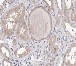 Invitrogen Phospho-PLA2G4A (Ser505) Polyclonal Antibody 100 μL; Unconjugated:Antibodies,