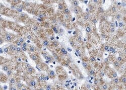 Invitrogen Phospho-TSC2 (Thr1462) Polyclonal Antibody 100 &mu;L | Buy Online | Invitrogen&trade; | Fisher Scientific