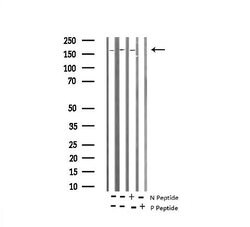 Invitrogen Phospho-TSC2 (Thr1462) Polyclonal Antibody 100 &mu;L | Buy Online | Invitrogen&trade; | Fisher Scientific