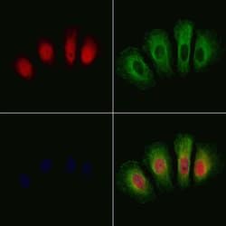 Invitrogen Phospho-GSK3 alpha/beta (Tyr279, Tyr216) Polyclonal Antibody