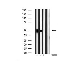 Invitrogen Phospho-GSK3 alpha/beta (Tyr279, Tyr216) Polyclonal Antibody