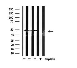 Invitrogen Phospho-GSK3 alpha/beta (Tyr279, Tyr216) Polyclonal Antibody