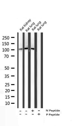 Invitrogen Phospho-STAT2 (Tyr690) Polyclonal Antibody 100 &mu;L | Buy Online | Invitrogen&trade; | Fisher Scientific