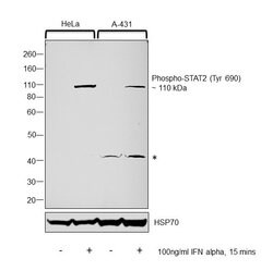 Invitrogen Phospho-STAT2 (Tyr690) Polyclonal Antibody 100 &mu;L | Buy Online | Invitrogen&trade; | Fisher Scientific