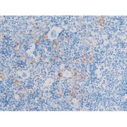 Invitrogen Phospho-LIMK1/LIMK2 (Thr508, Thr505) Polyclonal Antibody 100