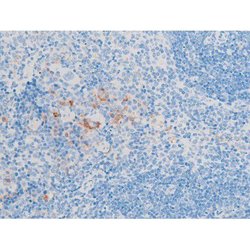 Invitrogen Phospho-LIMK1/LIMK2 (Thr508, Thr505) Polyclonal Antibody 100