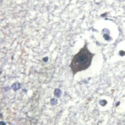 Invitrogen Phospho-LIMK2 (Ser283) Polyclonal Antibody 100 &mu;L; Unconjugated:Antibodies,