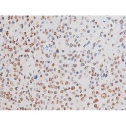 Invitrogen Phospho-LIMK2 (Ser283) Polyclonal Antibody 100 &mu;L; Unconjugated:Antibodies,