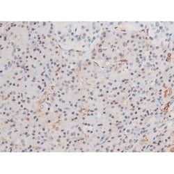 Invitrogen Phospho-LIMK2 (Ser283) Polyclonal Antibody 100 &mu;L; Unconjugated:Antibodies,