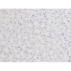 Invitrogen Phospho-LIMK2 (Ser283) Polyclonal Antibody 100 &mu;L; Unconjugated:Antibodies,