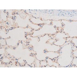 Invitrogen Phospho-LIMK2 (Ser283) Polyclonal Antibody 100 &mu;L; Unconjugated:Antibodies,
