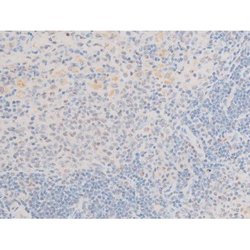 Invitrogen Phospho-LIMK2 (Ser283) Polyclonal Antibody 100 &mu;L; Unconjugated:Antibodies,
