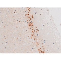 Invitrogen Phospho-LIMK2 (Ser283) Polyclonal Antibody 100 &mu;L; Unconjugated:Antibodies,