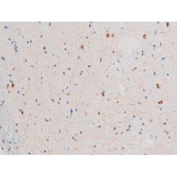 Invitrogen Phospho-LIMK2 (Ser283) Polyclonal Antibody 100 &mu;L; Unconjugated:Antibodies,