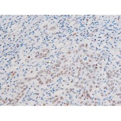 Invitrogen Phospho-LIMK2 (Ser283) Polyclonal Antibody 100 &mu;L; Unconjugated:Antibodies,
