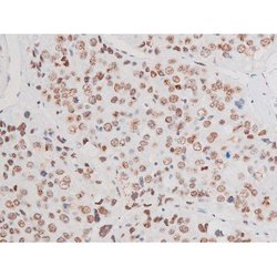 Invitrogen Phospho-LIMK2 (Ser283) Polyclonal Antibody 100 &mu;L; Unconjugated:Antibodies,