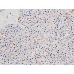 Invitrogen Phospho-LIMK2 (Ser283) Polyclonal Antibody 100 &mu;L; Unconjugated:Antibodies,
