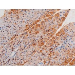 Invitrogen Phospho-LIMK2 (Ser283) Polyclonal Antibody 100 &mu;L; Unconjugated:Antibodies,