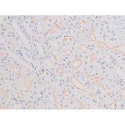 Invitrogen Phospho-LIMK2 (Ser283) Polyclonal Antibody 100 &mu;L; Unconjugated:Antibodies,