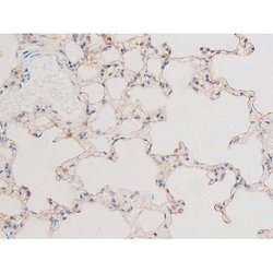 Invitrogen Phospho-LIMK2 (Ser283) Polyclonal Antibody 100 &mu;L; Unconjugated:Antibodies,