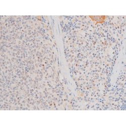 Invitrogen Phospho-LIMK2 (Ser283) Polyclonal Antibody 100 &mu;L; Unconjugated:Antibodies,